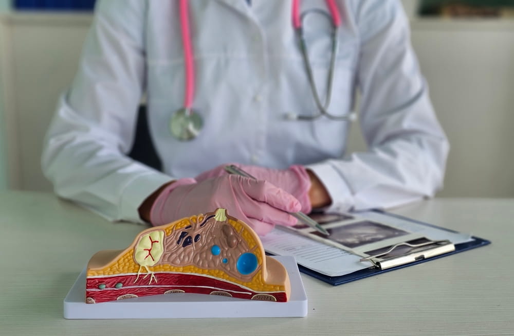 AI Breast Screening Cuts Later Cancer Diagnoses by 12%, Major Study Finds